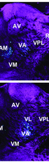 Characteristics of corticocortical and thalamocortical axon terminals during motor learning