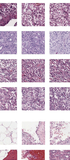 Deep learning-based survival prediction for multiple cancer types using histopathology images